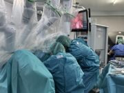 La innovació de la cirurgia robòtica davant l’endometriosi profunda