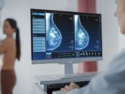 El nou PAI busca reduir les recaigudes i millorar la qualitat de vida en el càncer de mama